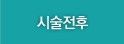 시술전후