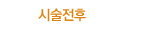 시술전후