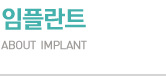 임플란트