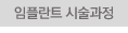 임플란트 시술과정