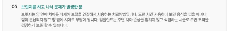 05. 브릿지를 하고 나서 문제가 발생한 분
브릿지는 양 옆에 치아를 삭제해 보철을 연결해서 사용하는 치료방법입니다. 오랜 시간 사용하다 보면 음식을 씹을 때마다
힘이 분산되지 않고 양 옆에 치아로 부담이 됩니다. 임플란트는 주변 치아 손상을 입히지 않고 식립하는 시술로 주변 조직을
건강하게 보존 할 수 있습니다.