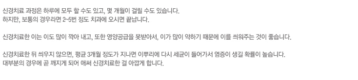 신경치료 과정은 하루에 모두 할 수도 있고, 몇 개월이 걸릴 수도 있습니다.
하지만, 보통의 경우라면 2~5번 정도 치과에 오시면 끝납니다.

신경치료한 이는 이도 많이 깍아 내고, 또한 영양공급을 못받아서, 이가 많이 약하기 때문에 이를 씌워주는 것이 좋습니다.

신경치료한 뒤 씌우지 않으면, 평균 3개월 정도가 지나면 이뿌리에 다시 세균이 들어가서 염증이 생길 확률이 높습니다.
대부분의 경우에 곧 깨지게 되어 애써 신경치료한 걸 아깝게 합니다.