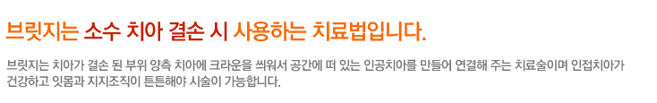 브릿지는 소수 치아 결손 시 사용하는 치료법입니다.
브릿지는 치아가 결손 된 부위 양측 치아에 크라운을 씌워서 공간에 떠 있는 인공치아를 만들어 연결해 주는 치료술이며 인접치아가 
건강하고 잇몸과 지지조직이 튼튼해야 시술이 가능합니다.